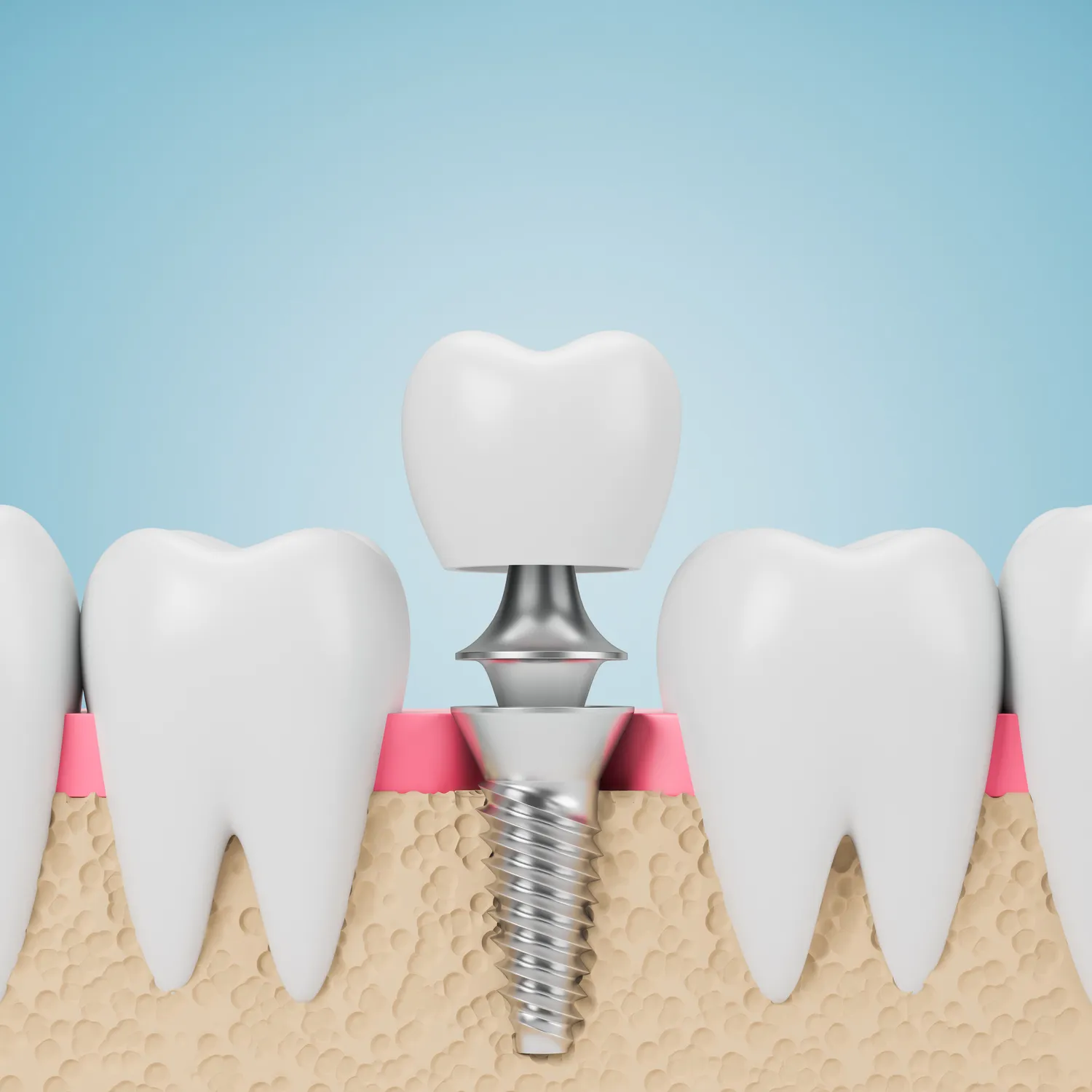 Jak pokonać lęk przed dentystą?